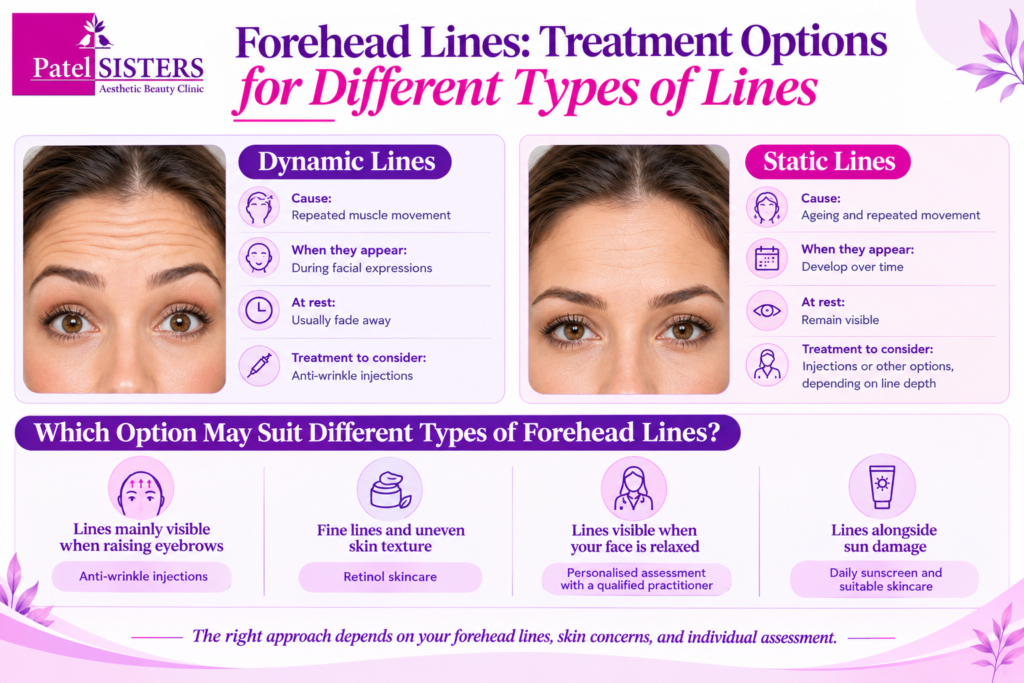 Forehead lines treatment options infographic comparing dynamic and static forehead lines, their causes, symptoms, anti-wrinkle injections, retinol skincare and sunscreen.